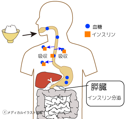 インスリンイラスト