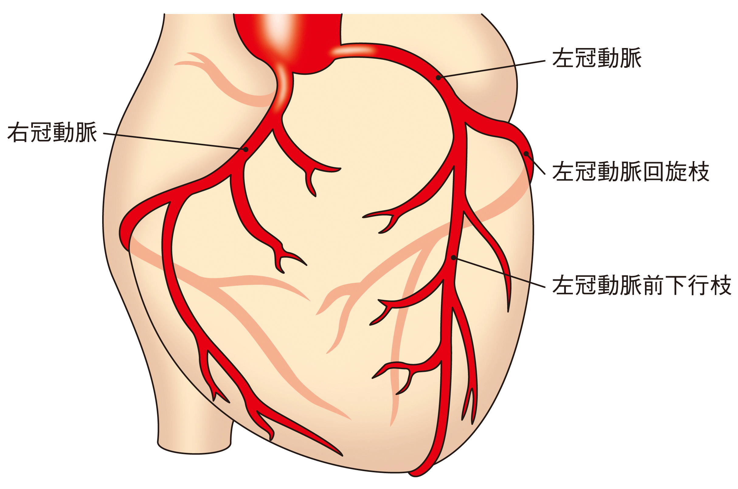 心筋梗塞 川崎大師いしまる内科クリニック