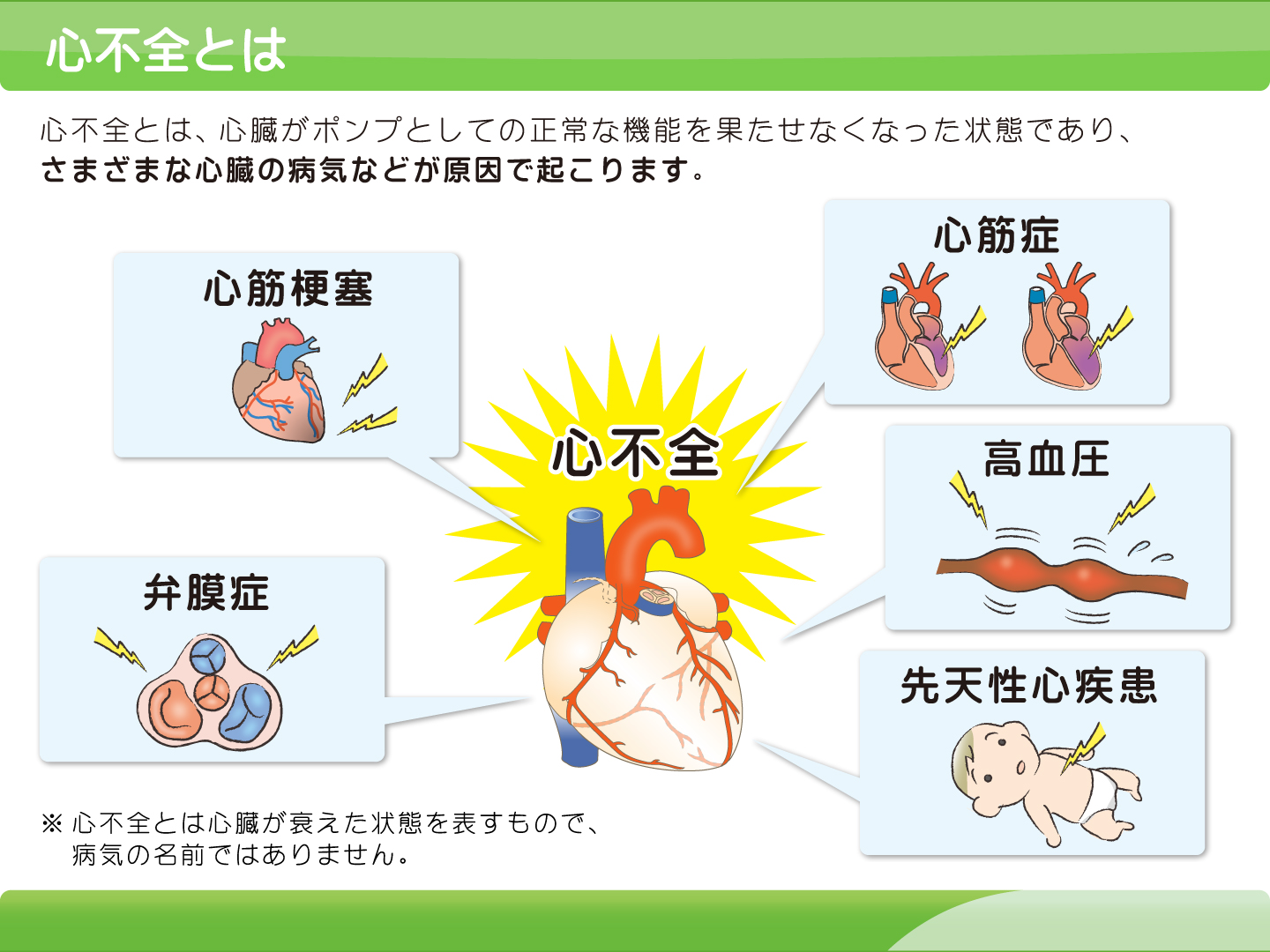 心不全とは