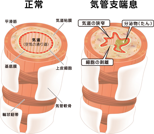 気管支イラスト