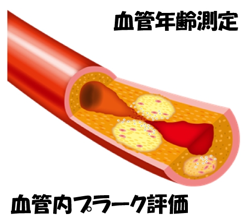 動脈硬化 血管の老化 の抑制 川崎大師いしまる内科クリニック